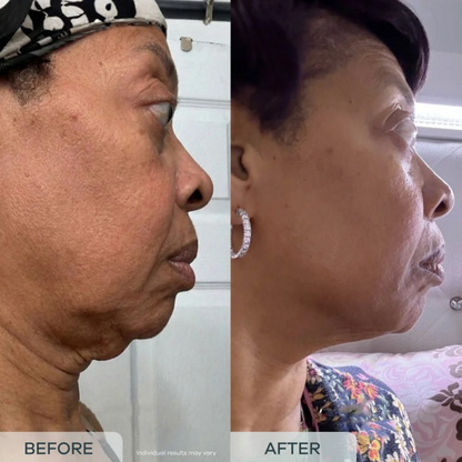 essence™ Age Reverse PDRN Serum (All-In-One)