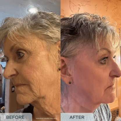 essence™ Age Reverse PDRN Serum (All-In-One)