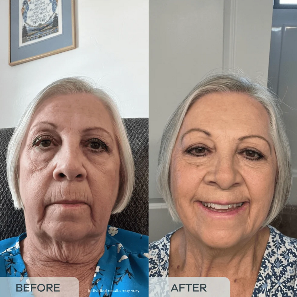 essence™ Age Reverse PDRN Serum (All-In-One)