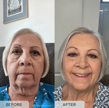 essence™ Age Reverse PDRN Serum (All-In-One)